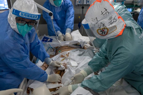 扬州重型23例危重型6例,这两种病症有何不同?