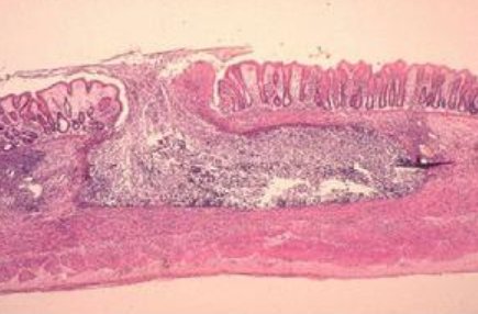 abo的成结是什么意思？
