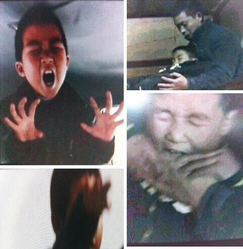 重庆僵尸男孩康复了吗 发病时像僵尸一样令人恐惧