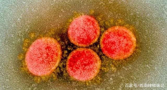 成都双流检测出环境样本阳性，什么是环境样本阳性？