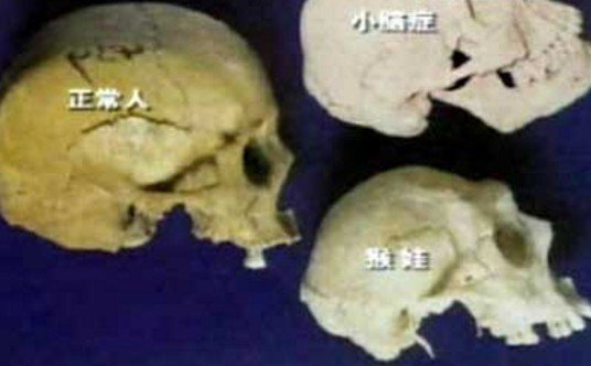 猴娃之谜最终解释