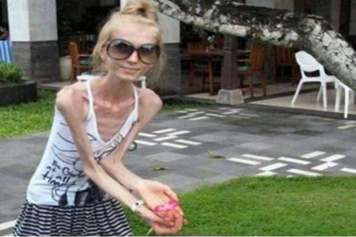 skinny是什么意思