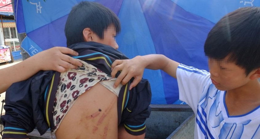 江西少年遭八人持刀围殴反杀一人被判10年，是正当防卫过当吗？