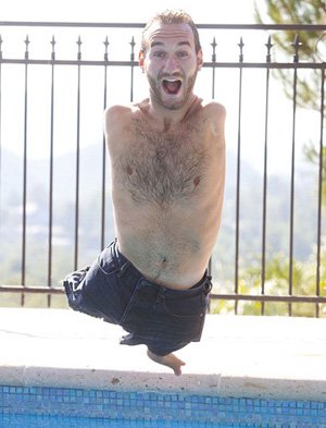 外国有一个无脚无手的演讲者是是谁啊