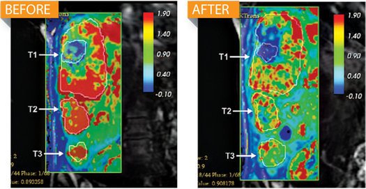 ALN-VSP的奥尼兰姆公司