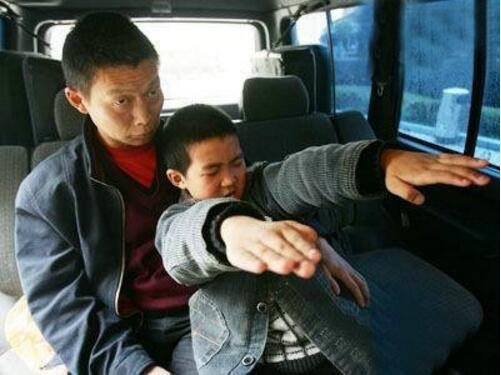 重庆僵尸男孩康复了吗 发病时像僵尸一样令人恐惧