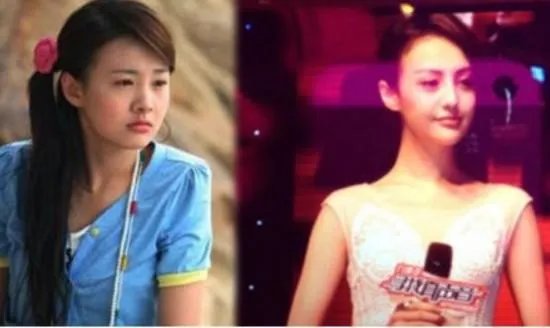 你们觉得郑爽整容前漂亮还是整容后漂亮？