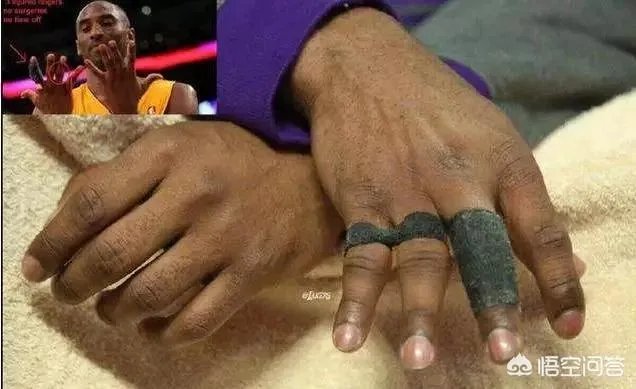 詹姆斯六个脚趾