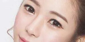 天津哪个医院埋线双眼皮好