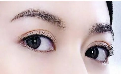 眼部抽脂什么价格