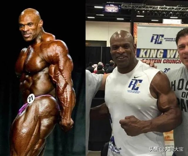 健美皇帝罗尼库尔曼最近又动手术了，难道竞技健美非得牺牲身体健康为代价嘛？