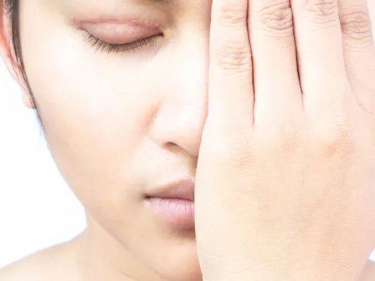 上睑下垂整复术后多久恢复