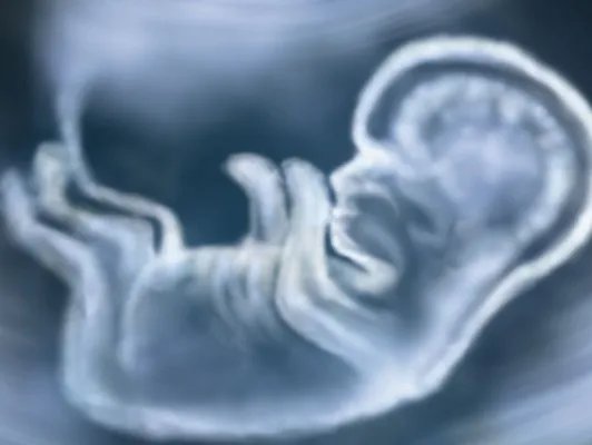 什么是四维彩超