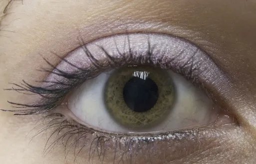 韩式定点双眼皮怎么做的