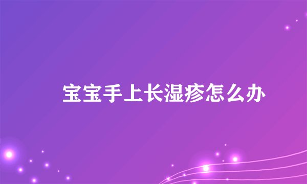 ​宝宝手上长湿疹怎么办