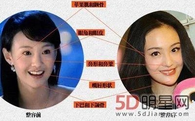 你们觉得郑爽整容前漂亮还是整容后漂亮？