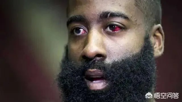 格林再次打到哈登眼睛，再次主动道歉。格林真的是无意的，还是装无辜？