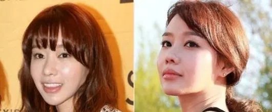 金雅中整容了吗:金雅中前后对比照