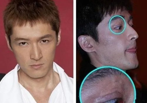 胡歌车祸前后对比照曝光 胡歌车祸原因大揭秘