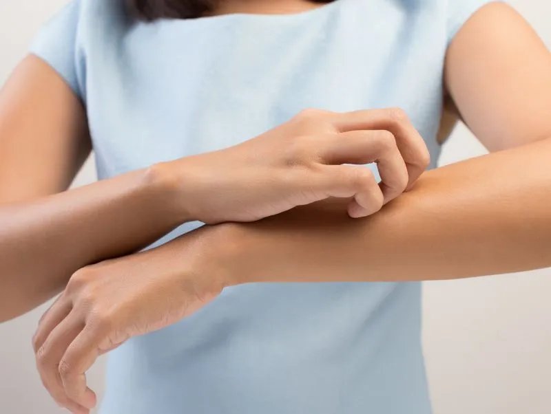 日光性皮炎能根治吗