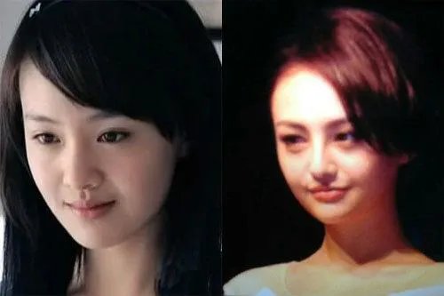 你们觉得郑爽整容前漂亮还是整容后漂亮？