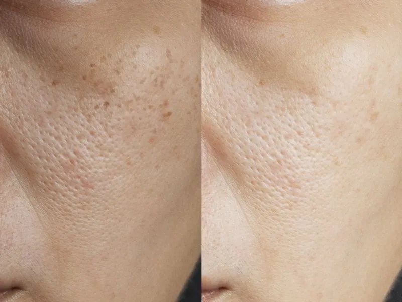 化妆品美白成分有哪些