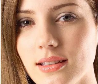 玻尿酸注射除皱多少钱