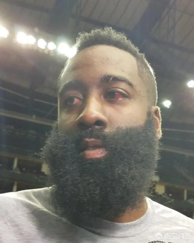 格林再次打到哈登眼睛，再次主动道歉。格林真的是无意的，还是装无辜？