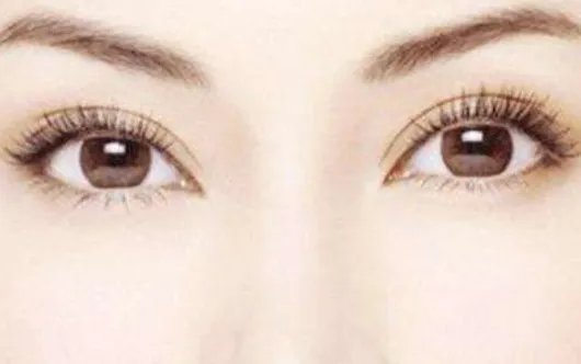 上海全切双眼皮哪几家整形医院做的好