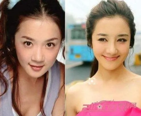 李依晓个人资料:李依晓整容前后照片对比(图)