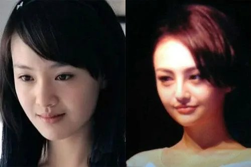 你们觉得郑爽整容前漂亮还是整容后漂亮？