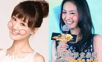 你们觉得郑爽整容前漂亮还是整容后漂亮？