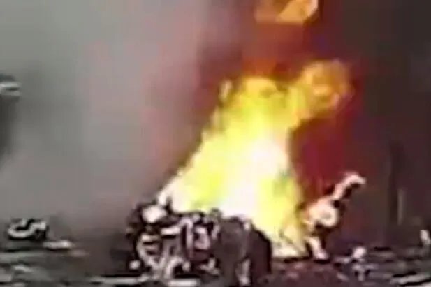 杭州电瓶车烧伤女孩或终生插管是怎么回事 杭州电瓶车烧伤女孩或终生插管具体情况