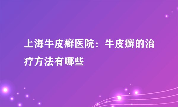 上海牛皮癣医院:牛皮癣的治疗方法有哪些