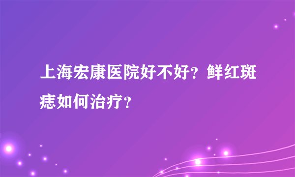 上海宏康医院好不好？鲜红斑痣如何治疗？