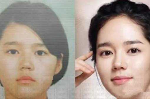 金雅中整容了吗:金雅中前后对比照