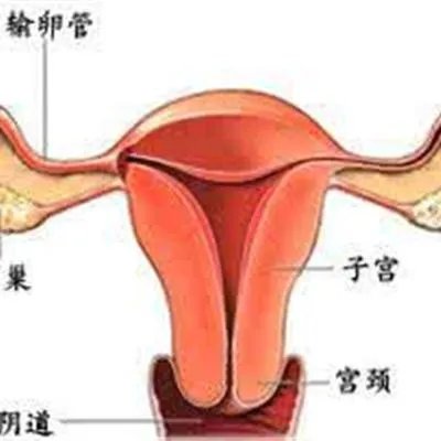 盆腔疾病有哪些?