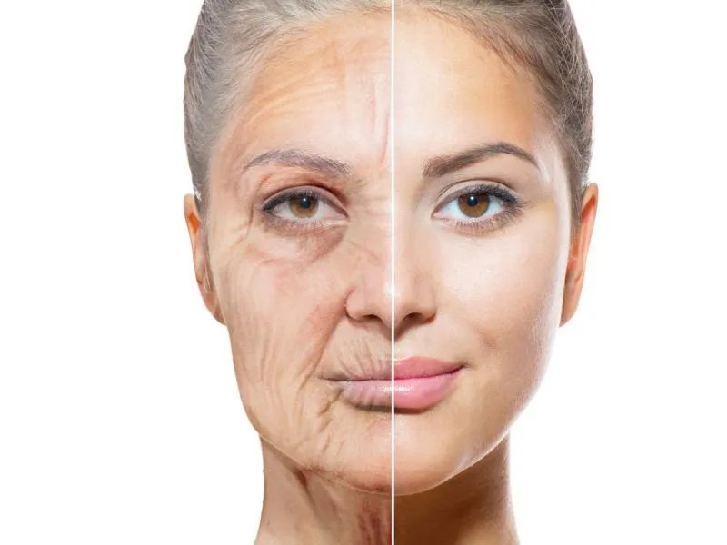 如何去除额头纹