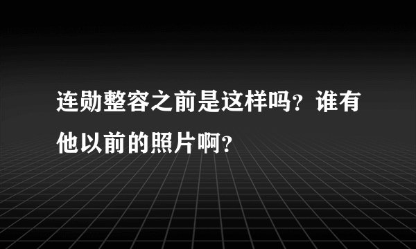 连勋整容之前是这样吗?谁有他以前的照片啊?