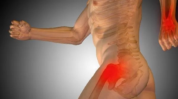 股骨颈骨折的手术费用