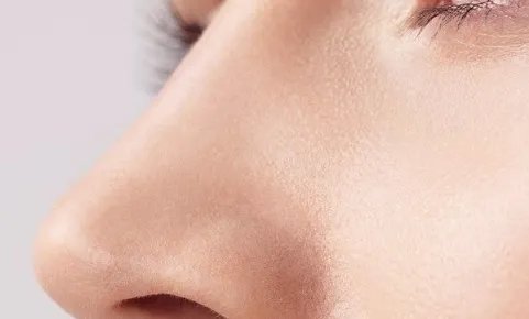 鼻翼整形费用是多少