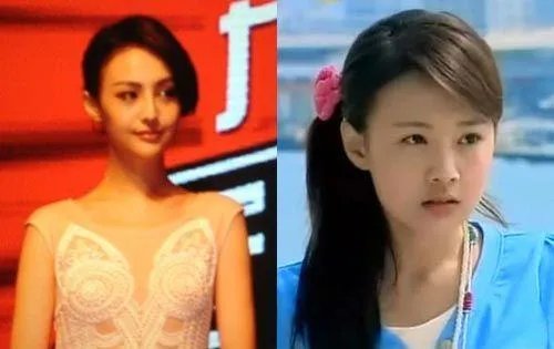 你们觉得郑爽整容前漂亮还是整容后漂亮？