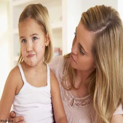 小儿过敏性鼻炎有哪些症状 小儿过敏性鼻炎的四个症状浅析