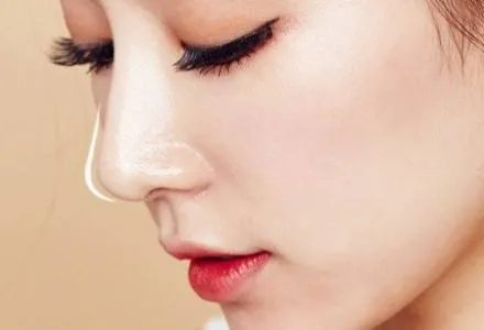 整一个鼻子要多少钱