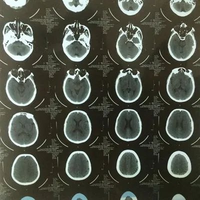 婴儿吃奶咳嗽怎么回事?