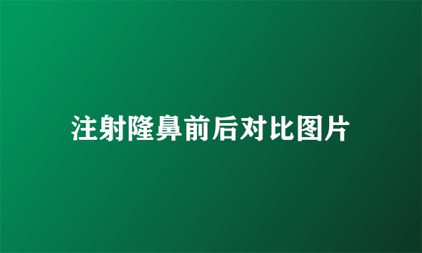 注射隆鼻前后对比图片