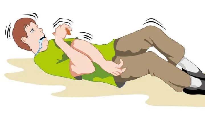 治疗癫痫好方法有哪些