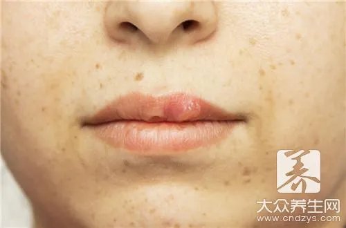  身上长痣面相图解大全