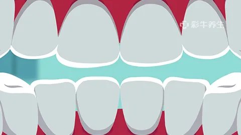 美白牙齿的方法