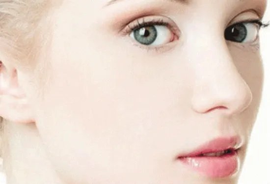 上海全切双眼皮哪几家整形医院做的好